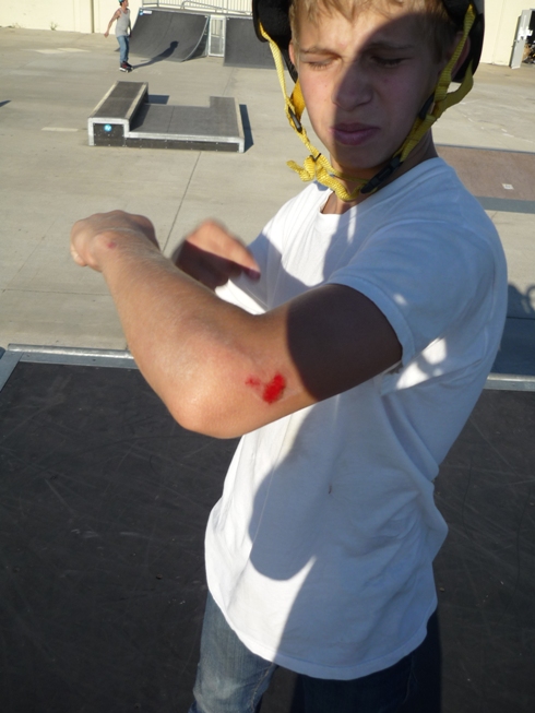 Eli's elbow! NOOOOOOOO Eli is one of Sacramento's up-and-comers.. look out for him in the future!